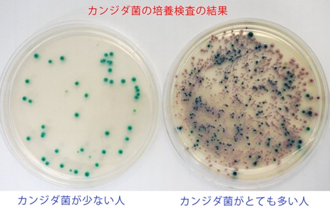 カンジダ菌の培養検査の結果